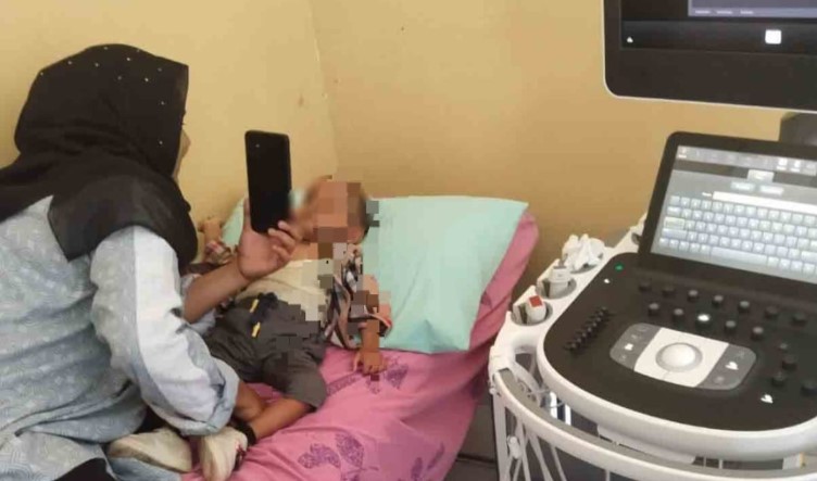 Himpitan Ekonomi, Bocah Penderita Bocor Jantung asal Samadua Butuh Bantuan untuk Operasi di RS Adam Malik Medan