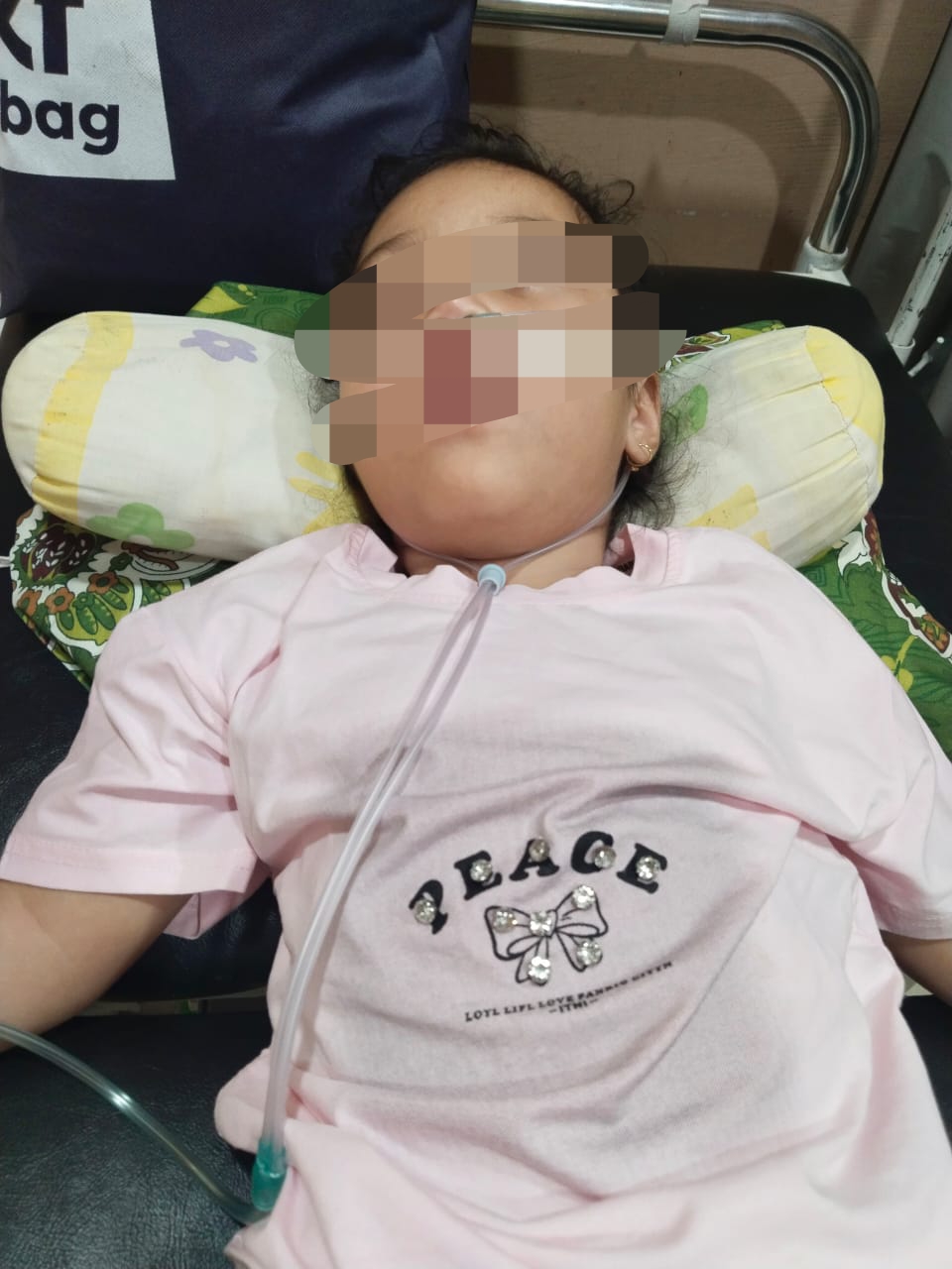 Alami Lumpuh Otak, Bocah Perempuan Asal Aceh Tenggara Butuh Uluran Tangan