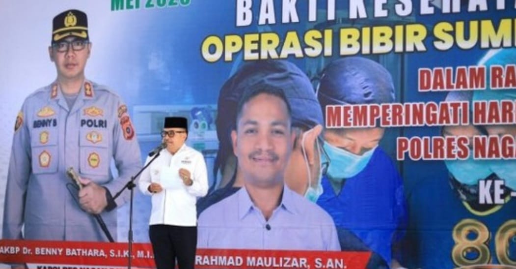 Rentetan Hari Bhayangkara 80, Bupati Nagan Raya Hadiri Bakti Sosial Operasi Bibir Sumbing di RSUD-SIM